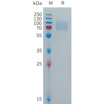 Human PEDF Protein, His Tag