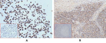 CD45 Antibody