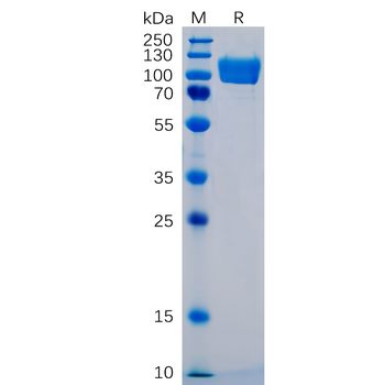 Human ROR2 Protein, His Tag