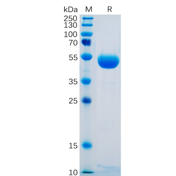 Human TGFBR1 Protein, N-hFc Tag