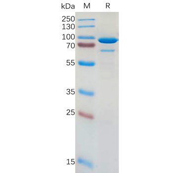 Human IL17RA Protein, His Tag