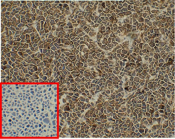 CD138 Antibody