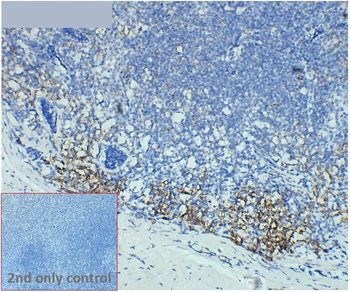 CD138 Antibody