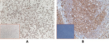 Mesothelin Antibody