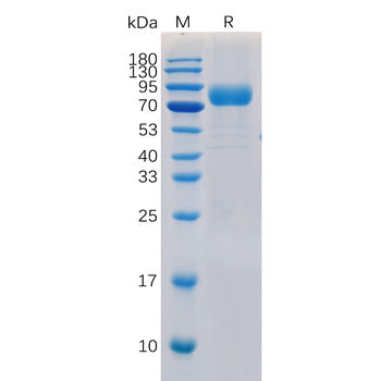 Human EPHA2 Protein, His Tag