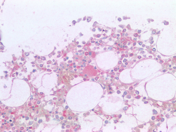 CD36 Antibody