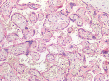 TNFRSF1B/TNFR2 Antibody