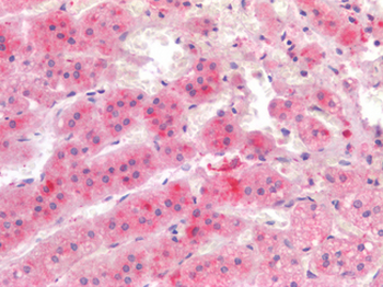 IL17A Antibody