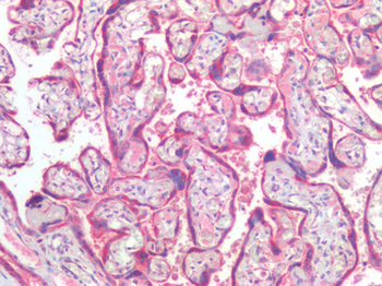 IFIH1/MDA5 Antibody