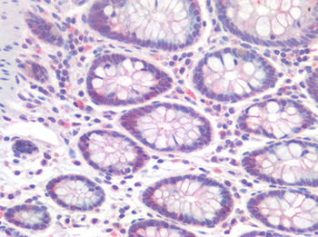 CTNND1/p120 Catenin Antibody