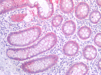 CTNND1/p120 Catenin Antibody