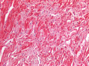 IL25/IL17E Antibody