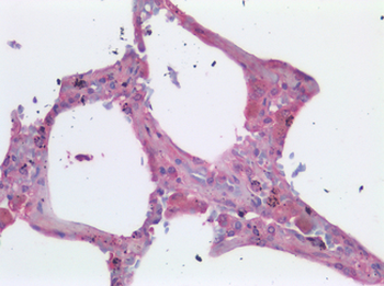 TNF Alpha Antibody