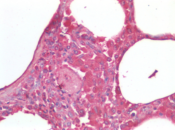 TNF Alpha Antibody