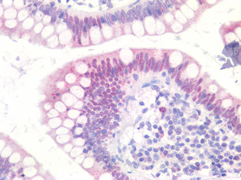 MKI67/Ki67 Antibody