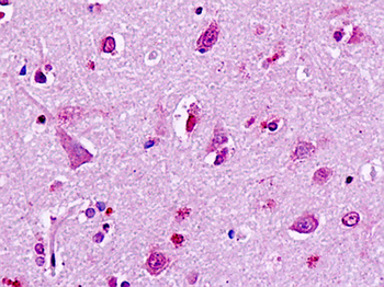 GPR49/LGR5 Antibody