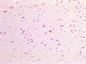 GAD65 Antibody