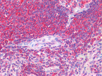 IL-1B/IL-1 Beta Antibody