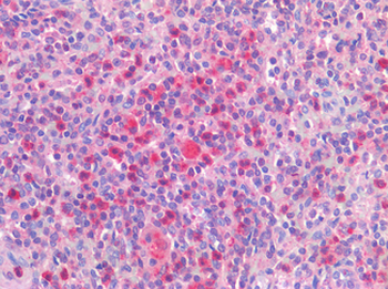 IL-1B/IL-1 Beta Antibody
