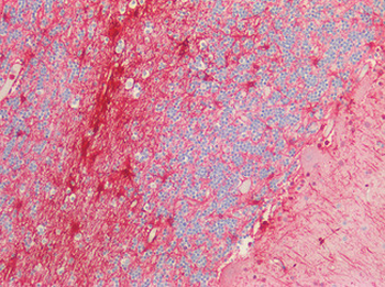 GFAP Antibody