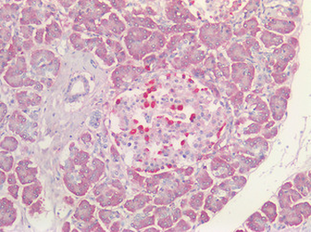 VPS35 Antibody