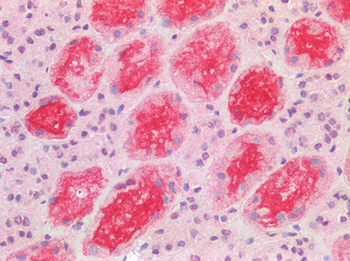 ACE2/ACE-2 Antibody