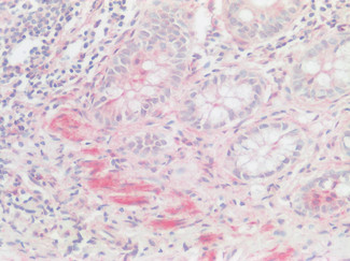 XCR1 Antibody