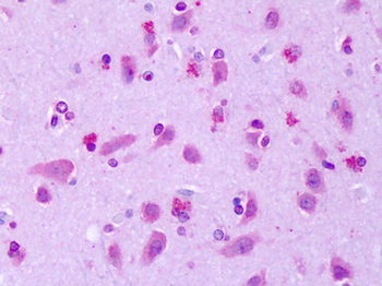 GPR75 Antibody