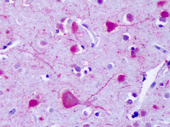 GPR75 Antibody