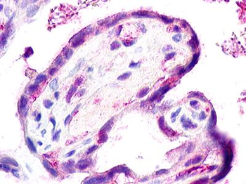 ACKR2/CCR10/D6 Antibody