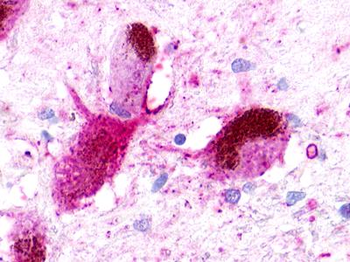 NMUR1 Antibody