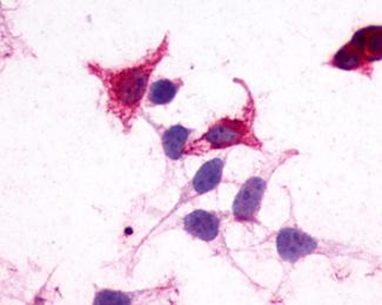GPR182/ADMR Antibody