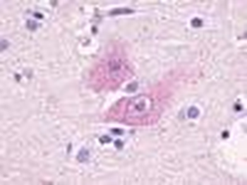 GPR37L1 Antibody