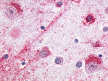 NMUR2 Antibody