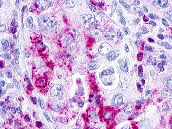 GPR152 Antibody