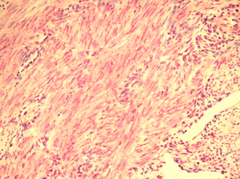 RXFP2/LGR8 Antibody