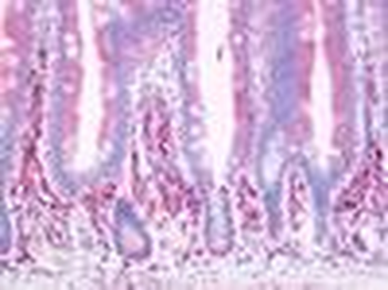 Prostaglandin D2 Receptor Antibody