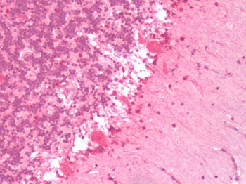 HTR6/5-HT6 Receptor Antibody