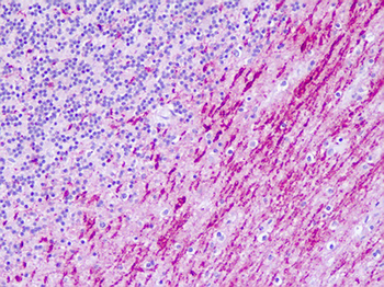 HTR6/5-HT6 Receptor Antibody