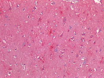 CALCRL/CGRP Receptor Antibody