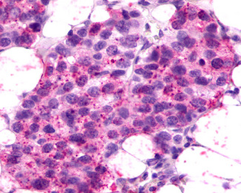 CXCR2 Antibody