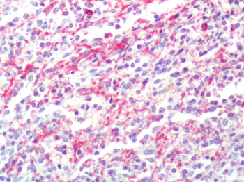 CXCR2 Antibody
