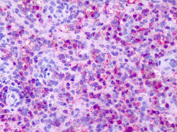 CXCR1 Antibody