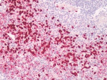 PGES/PTGES Antibody