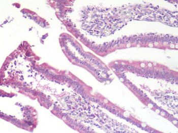 CCR9/CD199 Antibody