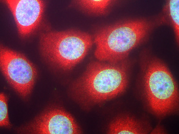 CSNK1A1/CK1 Alpha Antibody