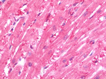 CRLF1 Antibody