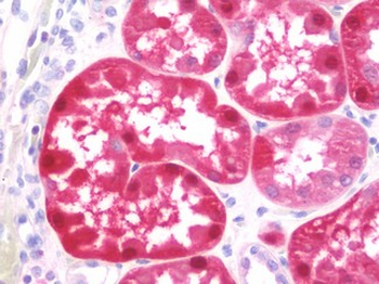 GSTA2 Antibody
