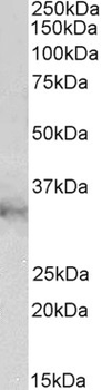 CLIC1/NCC27 Antibody
