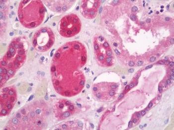 PSCA Antibody
